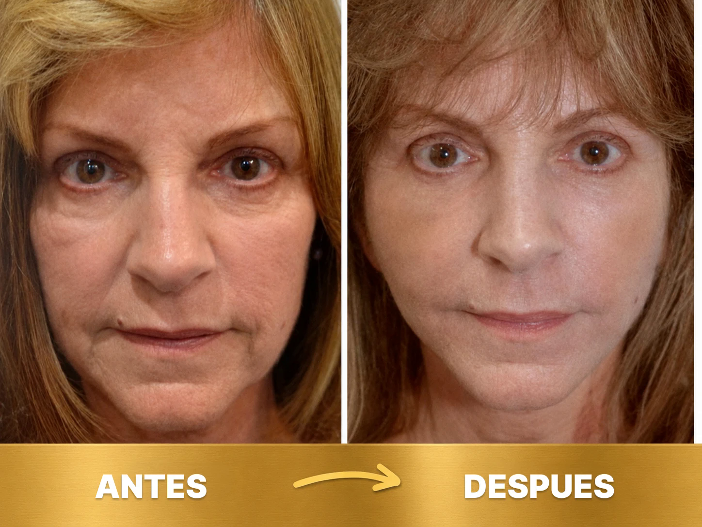 Resultado 2
