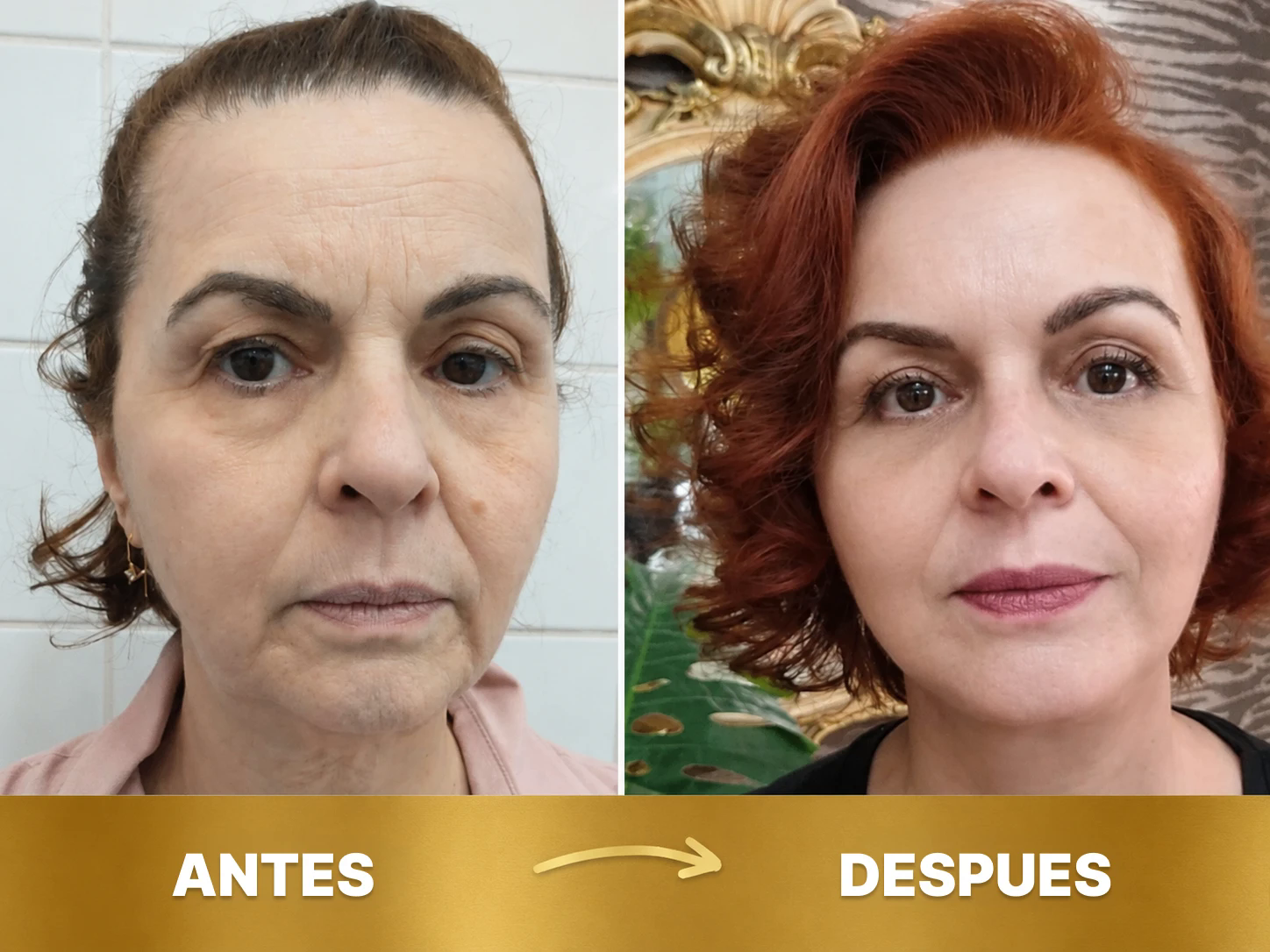Resultado 3